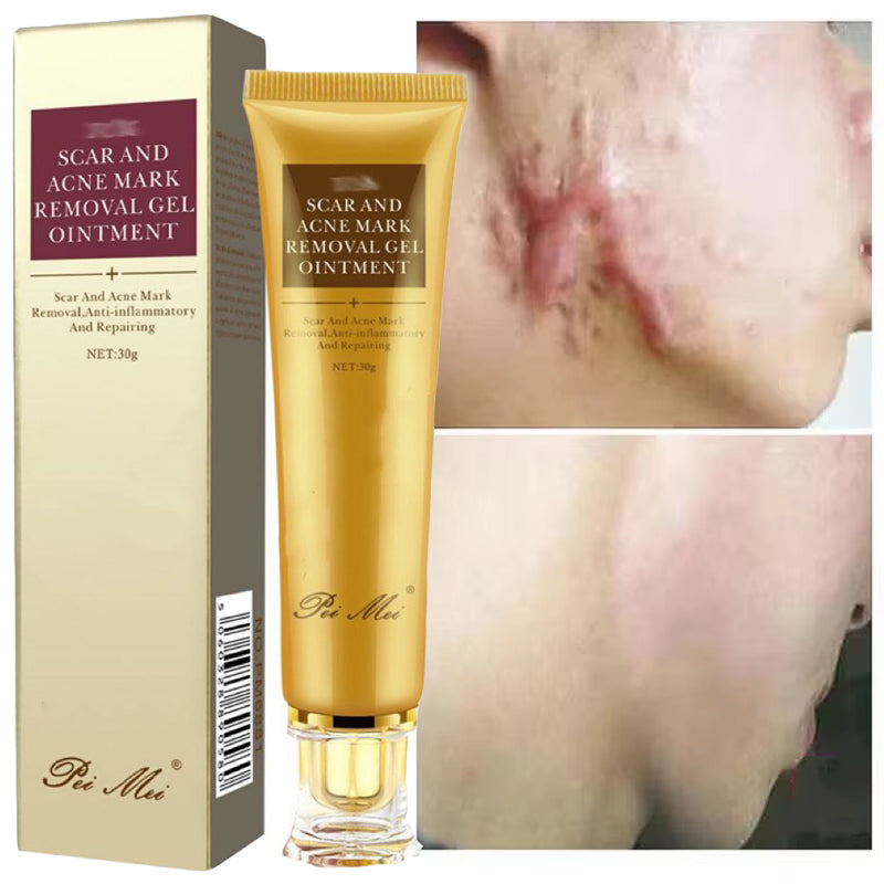 משחה לכוויות וטיפול בצלקות אקנה | ג'סטה שופ | Jesta Shop