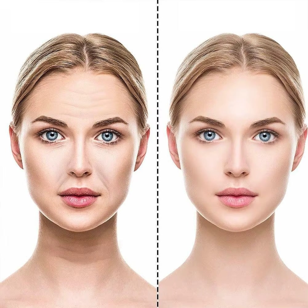 ערכת מדבקות פנים אנטי אייג'ינג למניעת קמטים | ג'סטה שופ | Jesta Shop