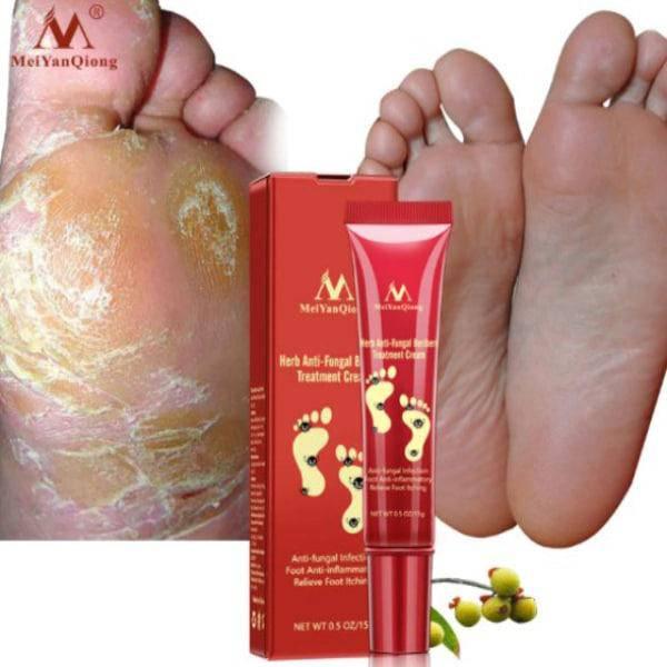 משחה ייחודית לטיפול בפטרת ברגליים | ג'סטה שופ | Jesta Shop