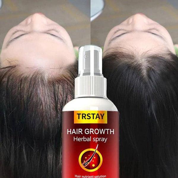 ספריי מעודד להאצת צמיחת השיער | ג'סטה שופ | Jesta Shop