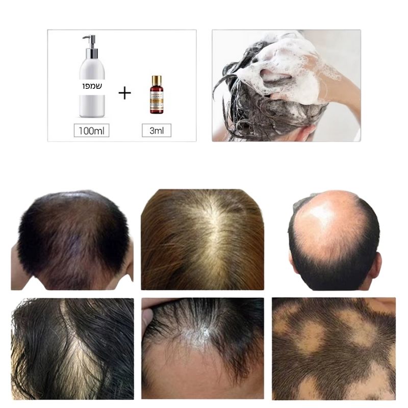 שמן לשיער לעידוד צמיחת שיער ומניעת נשירת שיער | ג'סטה שופ | Jesta Shop