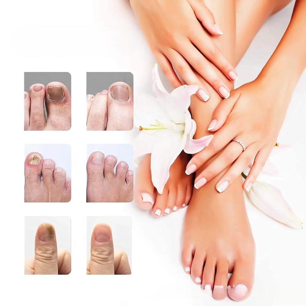 טיפות נגד פטרת ציפורניים | ג'סטה שופ | Jesta Shop