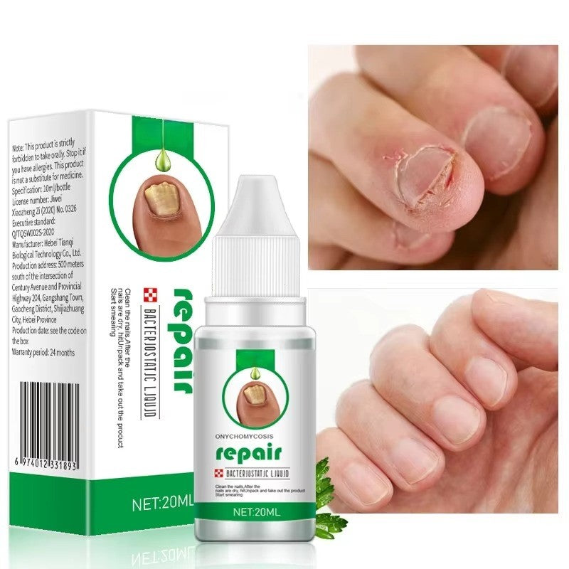 טיפות נגד פטרת ציפורניים | ג'סטה שופ | Jesta Shop