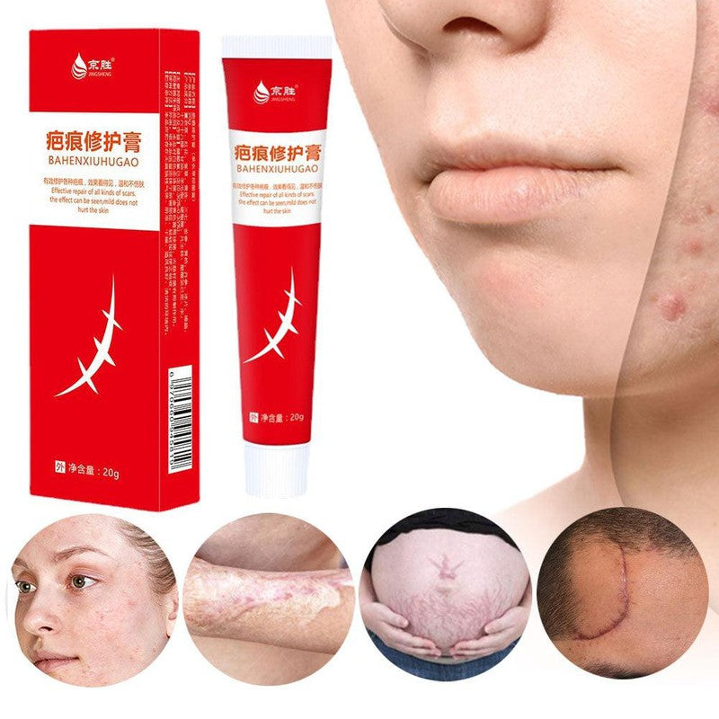 משחה נגד צלקות וטיפול בצלקות אקנה | ג'סטה שופ | Jesta Shop