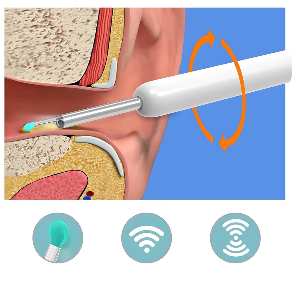 אנדוסקופ מצלמה חכם לניקוי אוזניים בשילוב תאורת LED | ג'סטה שופ | Jesta Shop