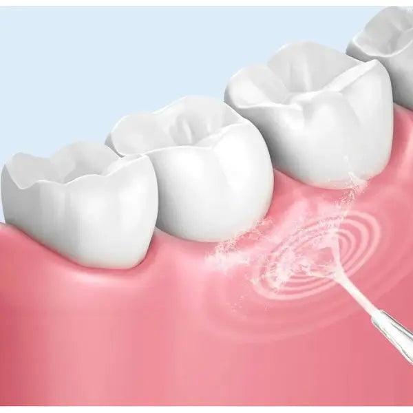 סילון מים דנטלי אלחוטי נטען לניקוי שיניים | ג'סטה שופ | Jesta Shop