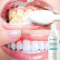 ספריי מוס להלבנת שיניים וניקיון חלל הפה | ג'סטה שופ | JestaShop